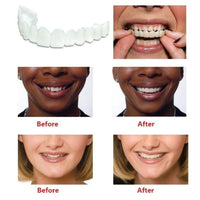 TrueSmile Instant Denture