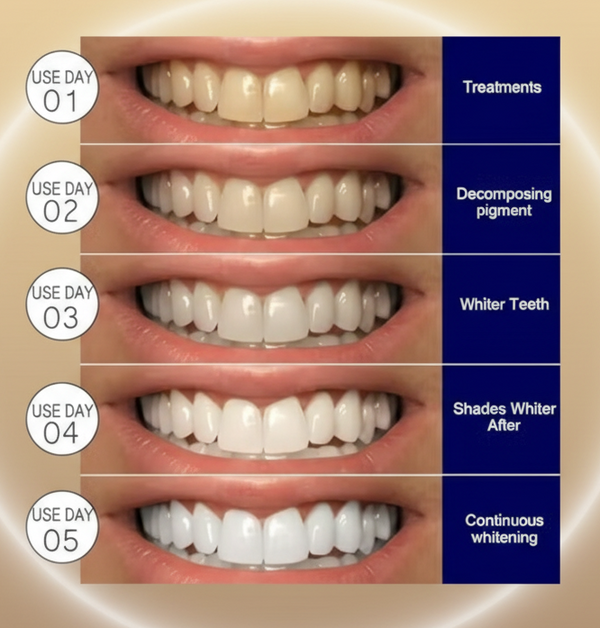 LumaWhite Smile Strips